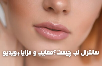 سانترال لب