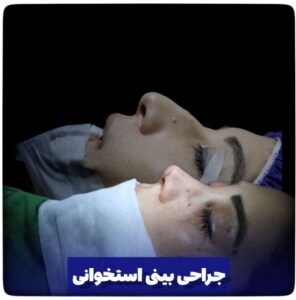 جراحی ترمیمی بینی