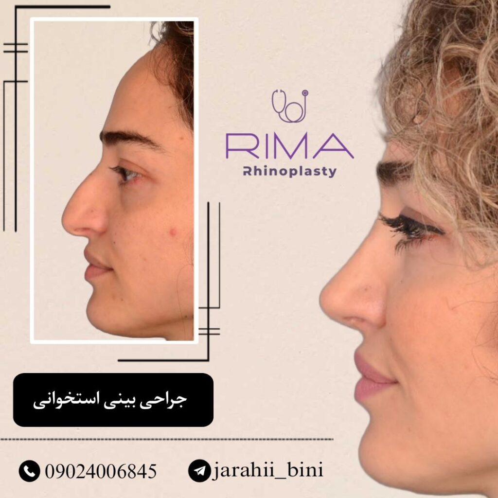 عمل بینی