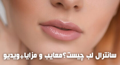 سانترال لب